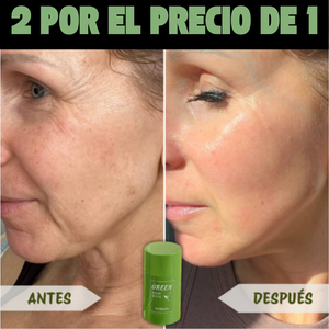 Mascarilla Anti Puntos Negros