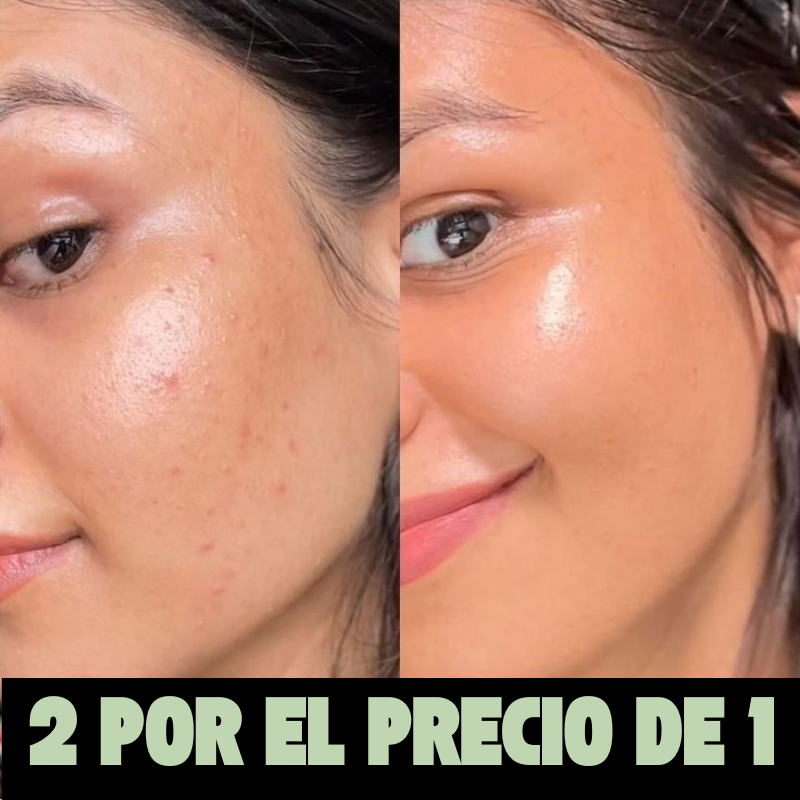 Mascarilla Anti Puntos Negros